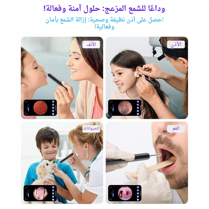 ⁦مزيل شمع الأذن مع كاميرا⁩ - الصورة ⁦4⁩